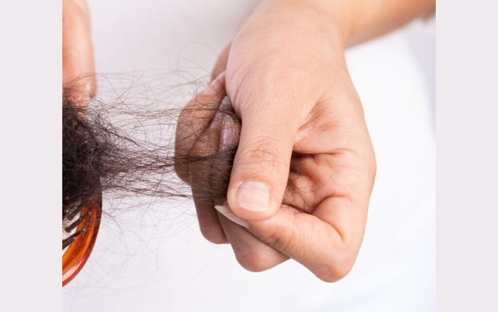 Causes of Hair Loss, Homeopathic Remedies for Hair fall Causes of Hair Loss, Homeopathic Remedies for Hair fall